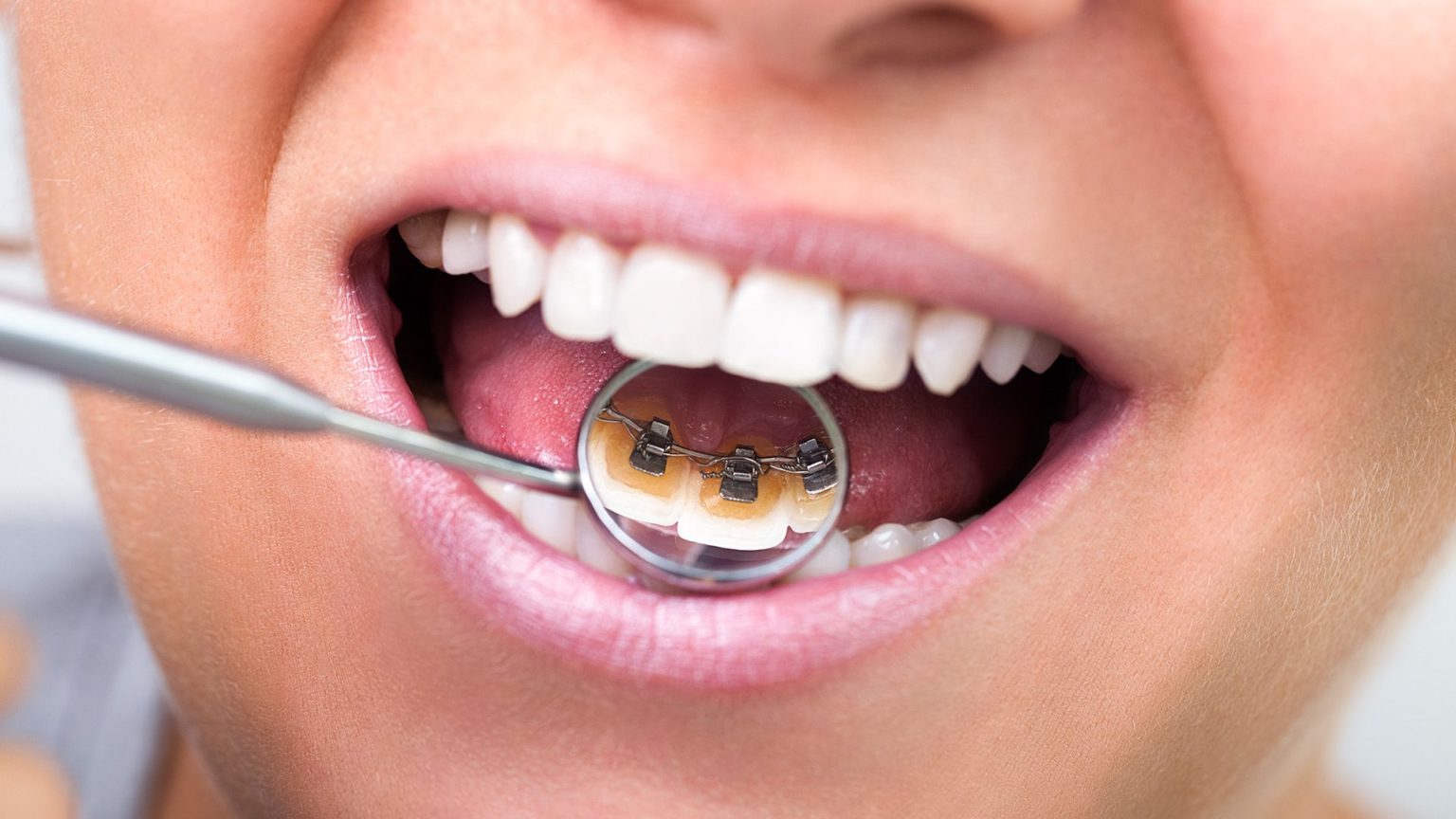 Ways You Can Chip Your Teeth Orthopädischen Praxis Dr. Rusch